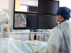 Астраханские врачи успешно извлекли тромб у перенесшего ишемический инсульт пенсионера