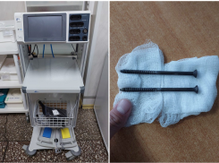 Крест в желудке: эндоскописты достали из астраханца саморезы