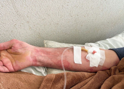 Астраханец получил 90% ожогов и выжил 