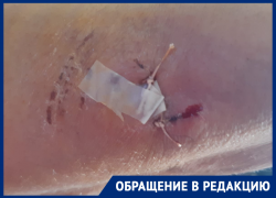 «Швы наложили в трех местах»: в Астраханской области собаки продолжают нападать на людей 