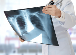 В Астрахани в Городской поликлинике №1 появился новый рентген