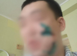 Астраханцу в кафе «Гранат» порезали лицо стаканом за оскорбление посетительницы