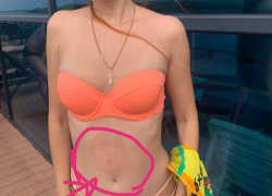 Истошно плакала и теряла сознание: астраханку засосало насосом в бассейне