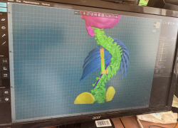 Пятилетней астраханке исправили врожденный сколиоз уникальной реберно-позвоночной конструкцией