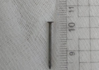 Годовалая астраханка с гвоздем в кишечнике была спасена врачами