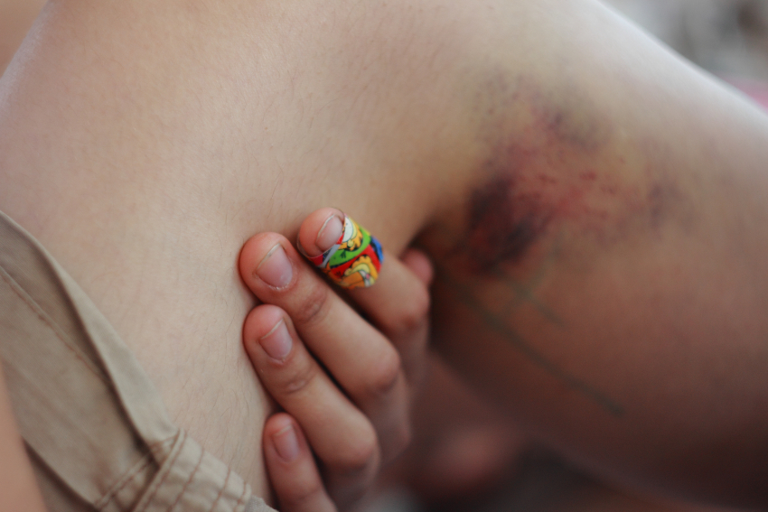 42-летний астраханец месяцами избивал пятерых своих детей