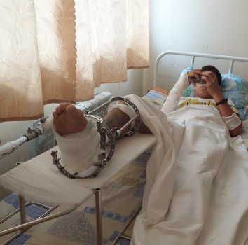 Астраханские врачи спасли ногу подростку, врачи в Астрахани, детская больница в Астрахани, врачи смогли спасти ногу астраханца